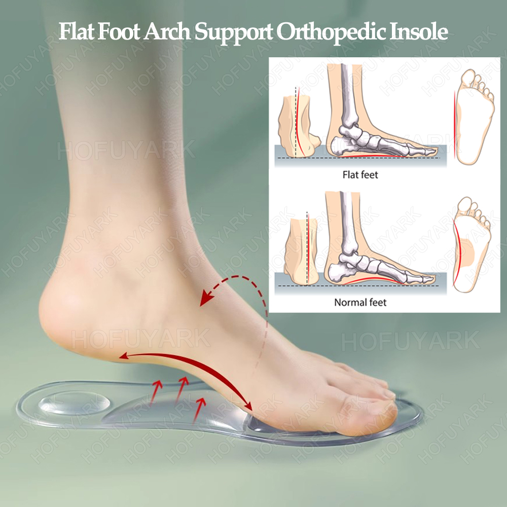 Siliconen Gel Inlegzolen Ortho - Women'S Shoes Plantar Fasciitis recensie en prijs