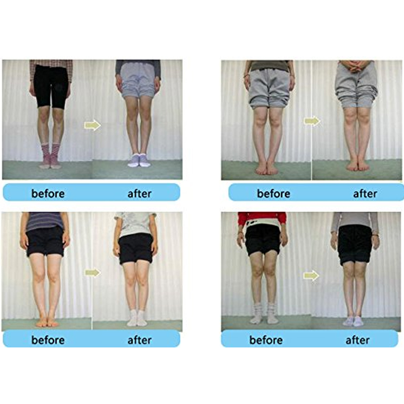 Tcare 1 Paar Orthopedische Inl - Women Shoes Types recensie en prijs