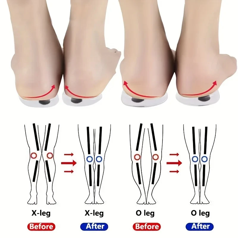 1 paar Orthopedische Inlegzole - Women Shoes Types recensie en prijs