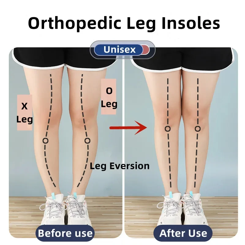 1 paar Orthopedische Inlegzole - Women Shoes Types recensie en prijs